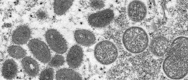 원숭이두창 바이러스 현미경 사진 © CDC(미국 질병통제예방센터) / Cynthia S. Goldsmith /이미지 제공=수의미래연구소