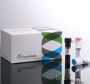 오상헬스케어(오상자이엘), 코로나19 진단키트 美 FDA 긴급사용승인 획득