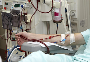 서울대병원-서울대, 혈액 투석 중 저혈압 예측하는 AI 모델 개발