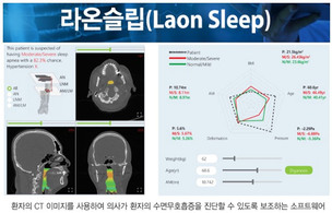 라온피플, AI 융합 폐쇄성 수면무호흡증 진단 소프트웨어 공개 시연