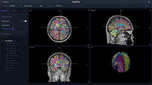 심평원, AI 영상 분석 솔루션 활용한 3D MRI 촬영 및 판독에 급여 인정