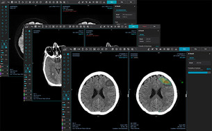제이엘케이, RSNA 2022에서 북미 시장 겨냥한 CT 기반 뇌졸중 토털 솔루션 공개