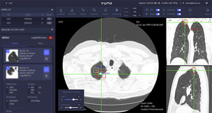 뷰노, 진단 효율 높이는 AI 의료영상 분석 기술 미국 특허 등록