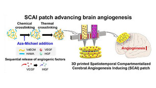국내 연구진, 3D 프린팅 기술 활용한 대뇌 혈관 신생 촉진 패치 개발