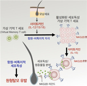 ‘원형탈모’ 발병 원인 찾았다! 국내연구진, 원인 면역세포 발견 및 치료법 제시