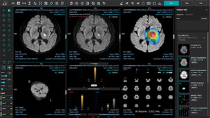 제이엘케이, 뇌 병변 분석 AI 원천기술 미국 특허 획득