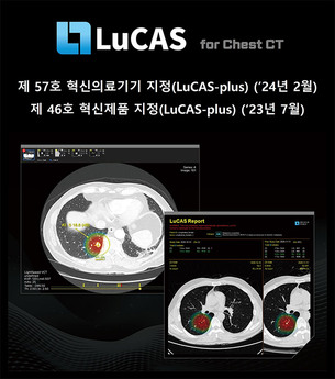 모니터코퍼레이션, AI 폐암 진단 솔루션 ‘LuCAS Plus’ 혁신의료기기 지정