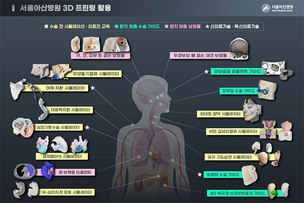 서울아산병원, 3D프린팅 도입 10년 “환자 중심 치료 실현에 유용” 