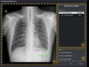 뷰웍스, 흉부 AI 진단 보조 솔루션 'VXCAD-CXR' 식약처 인허가 취득