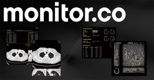 모니터코퍼레이션, 70억 규모 시리즈B 투자 유치&hellip;의료 AI 솔루션 해외 진출 본격화