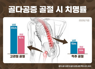 골다공증, 남성도 위험 “여성보다 치명률 높아”