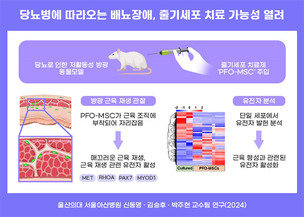 당뇨로 인한 배뇨장애, 줄기세포로 치료 가능성 열렸다