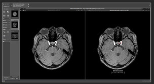 딥노이드 M4CXR, ChatGPT보다 정확한 흉부 X-ray 판독 성능 확인