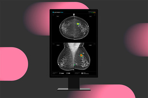 루닛, AI 활용한 유방암 단독 판독 효과 입증&hellip;진단 정확도 높이고 불필요한 재검사 방지