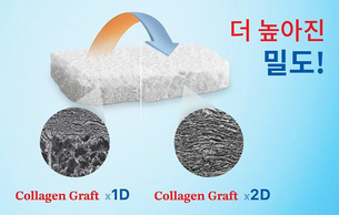 제노스, 고밀도 콜라겐 이식재 'Collagen Graft x2D' 출시&hellip;연조직 정밀 수복 기능 강화