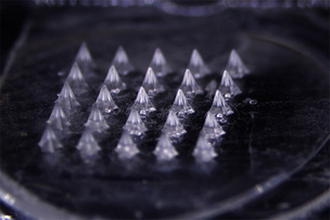 대웅 ‘마이크로니들’, 비만치료제 흡수율 80%…경쟁사 대비 진전