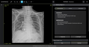 딥노이드, 생성형 AI ‘M4CXR’ 식약처 임상시험계획 승인