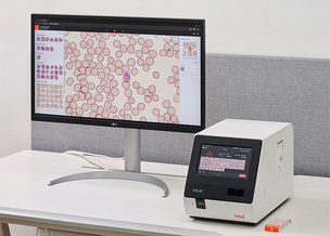 노을, 가나에 AI 말라리아 진단기기 공급… 98만 달러 규모 계약 체결