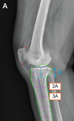 서울대병원, 2.6초 만에 무릎 수술 예후 예측 돕는 AI 모델 개발