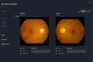메디웨일, 안질환 AI ‘닥터눈 펀더스’ 혁신의료기기 통합심사 승인