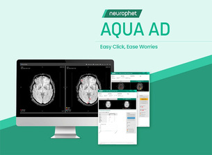 뉴로핏, 뇌 미세 출혈 검출 AI 소프트웨어 혁신의료기술 선정
