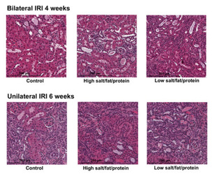 급성 신손상 회복기, 저염·저단백식이 답 아닐 수 있다