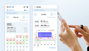 24시간 혈압 측정하는 반지형 혈압계…스카이랩스, 개인용 의료기기 ‘카트 비피’ 출시