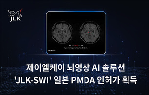 제이엘케이, 뇌영상 AI ‘JLK-SWI’ 日 PMDA 인허가 획득