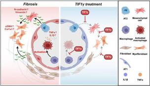 서울대병원, 폐섬유증 유전자 치료 가능성 제시