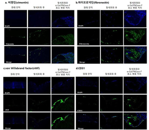 차세대 판막 이식 길 열리나? 돼지 심장판막에서 사람 재세포화 성공