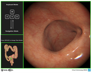 AI가 만든 ‘가상 대장’으로 내시경 훈련…서울대병원 시뮬레이터 개발