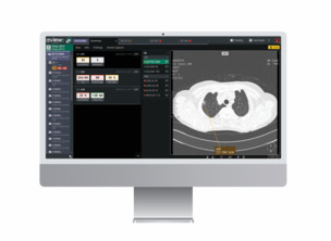 코어라인소프트, ‘AI 기반 시각화 기술’ 미국 특허 등록