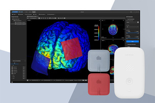 뉴로핏, 삼성서울병원에 개인 맞춤형 tDCS 솔루션 첫 공급…혁신의료기술 선정 후 적용 확대