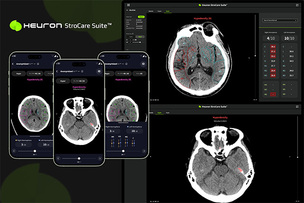 휴런, 뇌졸중 분석 AI 솔루션 일본 PMDA 허가…일본 시장 공식 진입