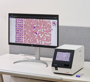 노을, CBC 통합 AI 혈액 분석 신제품 대만 첫 공급…3년간 40억 규모 계약