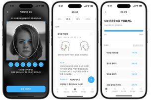 턱관절 장애, 디지털 치료 가능성 확인…스마트폰 앱으로 증상 개선