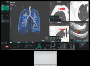 코어라인소프트, AI 폐결절 CAD 美 FDA 갱신