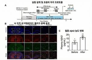 치매 원인 단백질 초음파 분해 가능성 제시…쥐 모델서 효과 확인