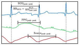 스마트워치 측정 심박수, 의료용으로 쓸 수 있을까&hellip;서울대병원 AI 분석법 제시