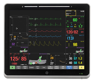 수술 중 통증 반응 '수치화' 기술, 제도권 진입&hellip;GE헬스케어 SPI 신의료기술 등재