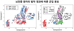 뇌전증 환자 발작 경과, AI 분석으로 5가지 유형 확인