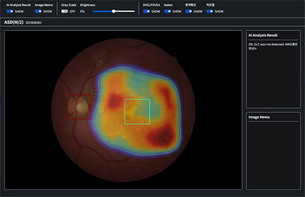 아크&middot;자이메드, 망막 기반 AI 협력&hellip;만성질환 합병증 스크리닝 플랫폼 출시 예정