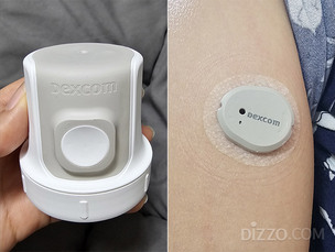 [헬스테크로그] 평범한 식사에도 '혈당 스파이크'&hellip;CGM 열흘 착용기