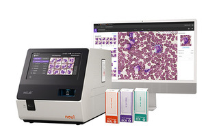 노을, 캐리비안 20개국 대상 AI 진단 플랫폼 공급 계약 체결