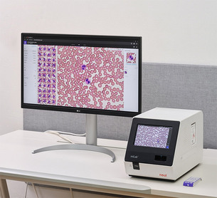 AI 현장진단 확대…혈액 검사도 ‘POCT+AI’ 흐름