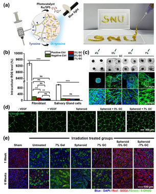 방사선에 망가진 침샘, ‘환경 제어+줄기세포’로 기능 회복 가능성 제시