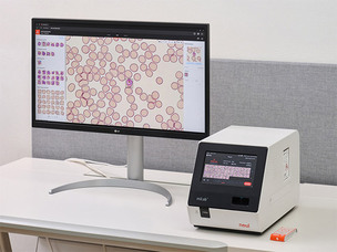 노을, 우간다에 AI 진단 장비 100대 공급 계약
