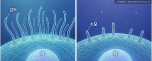 단독으론 영향 작던 희귀 변이&hellip;'유전자 쌍' 되자 자폐 연관성 커져
