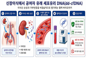 신장이식 거부반응, 혈액검사로 저위험군 선별…조직검사 판단 정밀도 향상