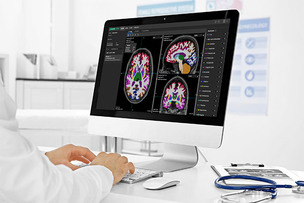 뉴로핏, 싱가포르 래플즈병원에 뇌 MRI 분석 AI 공급